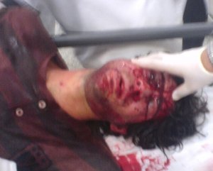Students have faced violence for being at the forefront of anti regime demonstrations